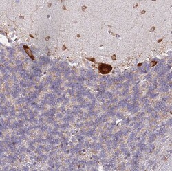 Invitrogen RPL8 Polyclonal Antibody 100 &mu;L; Unconjugated:Antibodies,