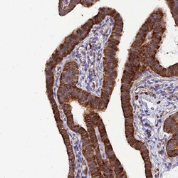 Invitrogen RPL8 Polyclonal Antibody 100 &mu;L; Unconjugated:Antibodies,