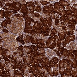 Invitrogen RPL8 Polyclonal Antibody 100 &mu;L; Unconjugated:Antibodies,