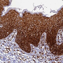 Invitrogen RPL8 Polyclonal Antibody 100 &mu;L; Unconjugated:Antibodies,