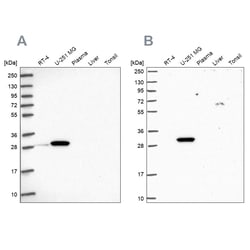 Invitrogen RPL8 Polyclonal Antibody 100 &mu;L; Unconjugated:Antibodies,