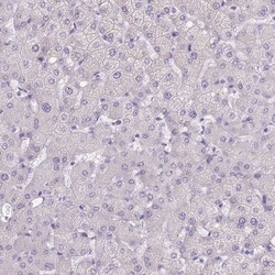 Invitrogen TMEM236 Polyclonal Antibody 100 &mu;L; Unconjugated:Antibodies,