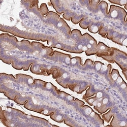 Invitrogen TMEM236 Polyclonal Antibody 100 &mu;L; Unconjugated:Antibodies,