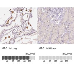 CD206 Polyclonal Antibody, Invitrogen 100 &mu;L; Unconjugated:Antibodies,