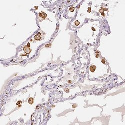 CD206 Polyclonal Antibody, Invitrogen 100 &mu;L; Unconjugated:Antibodies,