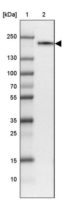 CD206 Polyclonal Antibody, Invitrogen 100 &mu;L; Unconjugated:Antibodies,