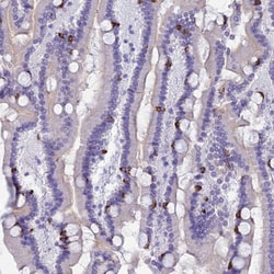MUC13 Polyclonal Antibody:Antibodies, Polyclonal