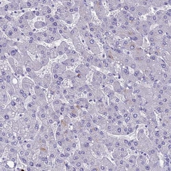 MUC13 Polyclonal Antibody:Antibodies, Polyclonal
