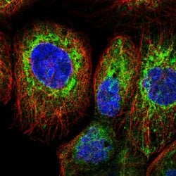 FKBP8 Polyclonal Antibody, Invitrogen 100 &mu;L; Unconjugated:Antibodies,