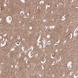 FKBP8 Polyclonal Antibody, Invitrogen 100 &mu;L; Unconjugated:Antibodies,