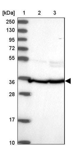 FKBP8 Polyclonal Antibody, Invitrogen 100 &mu;L; Unconjugated:Antibodies,