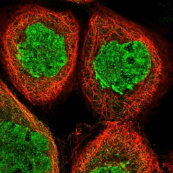 Invitrogen SGMS1 Polyclonal Antibody 100 &mu;L; Unconjugated:Antibodies,