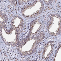 Invitrogen SGMS1 Polyclonal Antibody 100 &mu;L; Unconjugated:Antibodies,