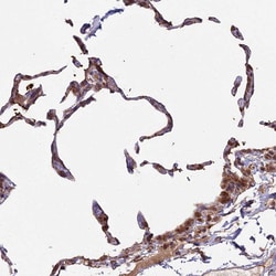Invitrogen MOX1 Polyclonal Antibody 100 &mu;L; Unconjugated:Antibodies,