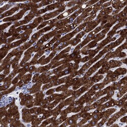 Invitrogen CYP2D6 Polyclonal Antibody 100 &mu;L; Unconjugated:Antibodies,