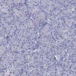 Invitrogen CYP2D6 Polyclonal Antibody 100 &mu;L; Unconjugated:Antibodies,