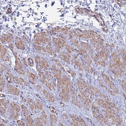 Invitrogen MRLC2 Polyclonal Antibody 100 &mu;L; Unconjugated:Antibodies,
