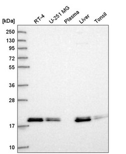 Invitrogen MRLC2 Polyclonal Antibody 100 &mu;L | Buy Online | Invitrogen&trade; | Fisher Scientific