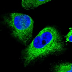 Invitrogen STC2 Polyclonal Antibody 100 &mu;L; Unconjugated:Antibodies,