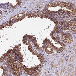 Invitrogen STC2 Polyclonal Antibody 100 &mu;L; Unconjugated:Antibodies,
