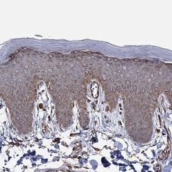 Invitrogen STC2 Polyclonal Antibody 100 &mu;L; Unconjugated:Antibodies,