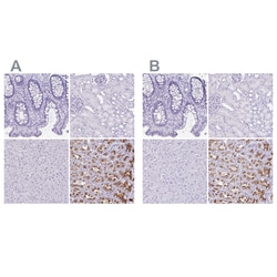 Invitrogen ATP4B Polyclonal Antibody 100 &mu;L; Unconjugated:Antibodies,