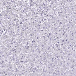 Invitrogen ATP4B Polyclonal Antibody 100 &mu;L; Unconjugated:Antibodies,