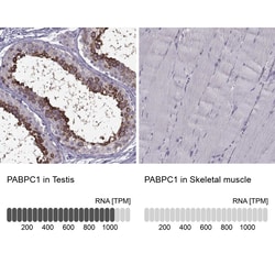 Invitrogen PABPC1 Polyclonal Antibody 100 &mu;L; Unconjugated:Anticuerpos