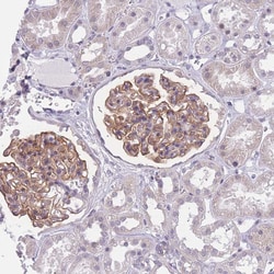 PODXL Polyclonal Antibody:Antibodies, Polyclonal