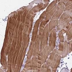 Invitrogen Cofilin 2 Polyclonal Antibody 100 &mu;L; Unconjugated:Antibodies,