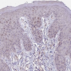 Invitrogen Cofilin 2 Polyclonal Antibody 100 &mu;L; Unconjugated:Antibodies,