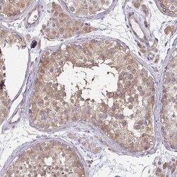 Invitrogen Cofilin 2 Polyclonal Antibody 100 &mu;L; Unconjugated:Antibodies,