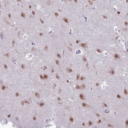 Invitrogen Nova-2 Polyclonal Antibody 100 &mu;L; Unconjugated:Antibodies,