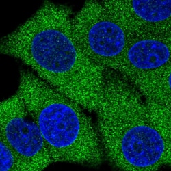 Invitrogen AMPD2 Polyclonal Antibody 100 &mu;L; Unconjugated:Antibodies,