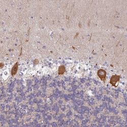 Invitrogen AMPD2 Polyclonal Antibody 100 &mu;L; Unconjugated:Antibodies,
