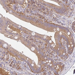 Invitrogen AMPD2 Polyclonal Antibody 100 &mu;L; Unconjugated:Antibodies,