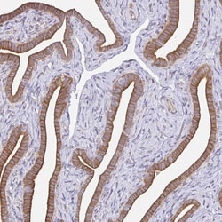 Invitrogen AMPD2 Polyclonal Antibody 100 &mu;L; Unconjugated:Antibodies,