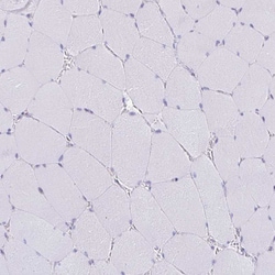 Invitrogen AMPD2 Polyclonal Antibody 100 &mu;L; Unconjugated:Antibodies,