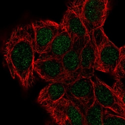 Invitrogen DPH2 Polyclonal Antibody 100 &mu;L; Unconjugated:Antibodies,
