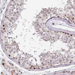 Invitrogen DPH2 Polyclonal Antibody 100 &mu;L; Unconjugated:Antibodies,