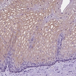 Invitrogen Claudin 17 Polyclonal Antibody 100 &mu;L; Unconjugated:Antibodies,