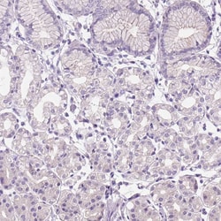 Invitrogen Claudin 17 Polyclonal Antibody 100 &mu;L; Unconjugated:Antibodies,