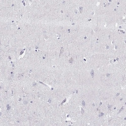 Invitrogen PMCH Polyclonal Antibody 100 &mu;L; Unconjugated:Antibodies,