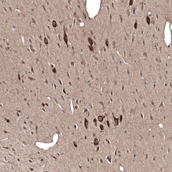 Invitrogen PMCH Polyclonal Antibody 100 &mu;L; Unconjugated:Antibodies,