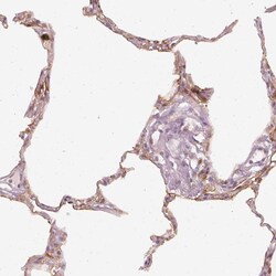 Invitrogen DAPP1 Polyclonal Antibody 100 &mu;L | Buy Online | Invitrogen&trade; | Fisher Scientific