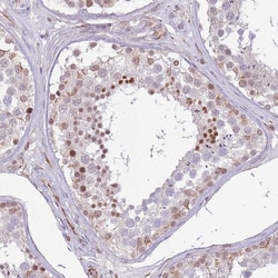 Invitrogen ELL Polyclonal Antibody 100 &mu;L; Unconjugated:Antibodies,