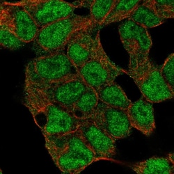 Invitrogen JARID1C Polyclonal Antibody 100 &mu;L; Unconjugated:Antibodies,