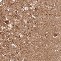 SNAP alpha Polyclonal Antibody:Antibodies, Polyclonal