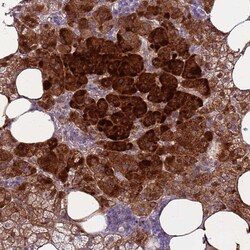Invitrogen RSPO1 Polyclonal Antibody 100 &mu;L; Unconjugated:Antibodies,