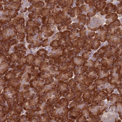 Invitrogen RPL17 Polyclonal Antibody 100 &mu;L; Unconjugated:Antibodies,